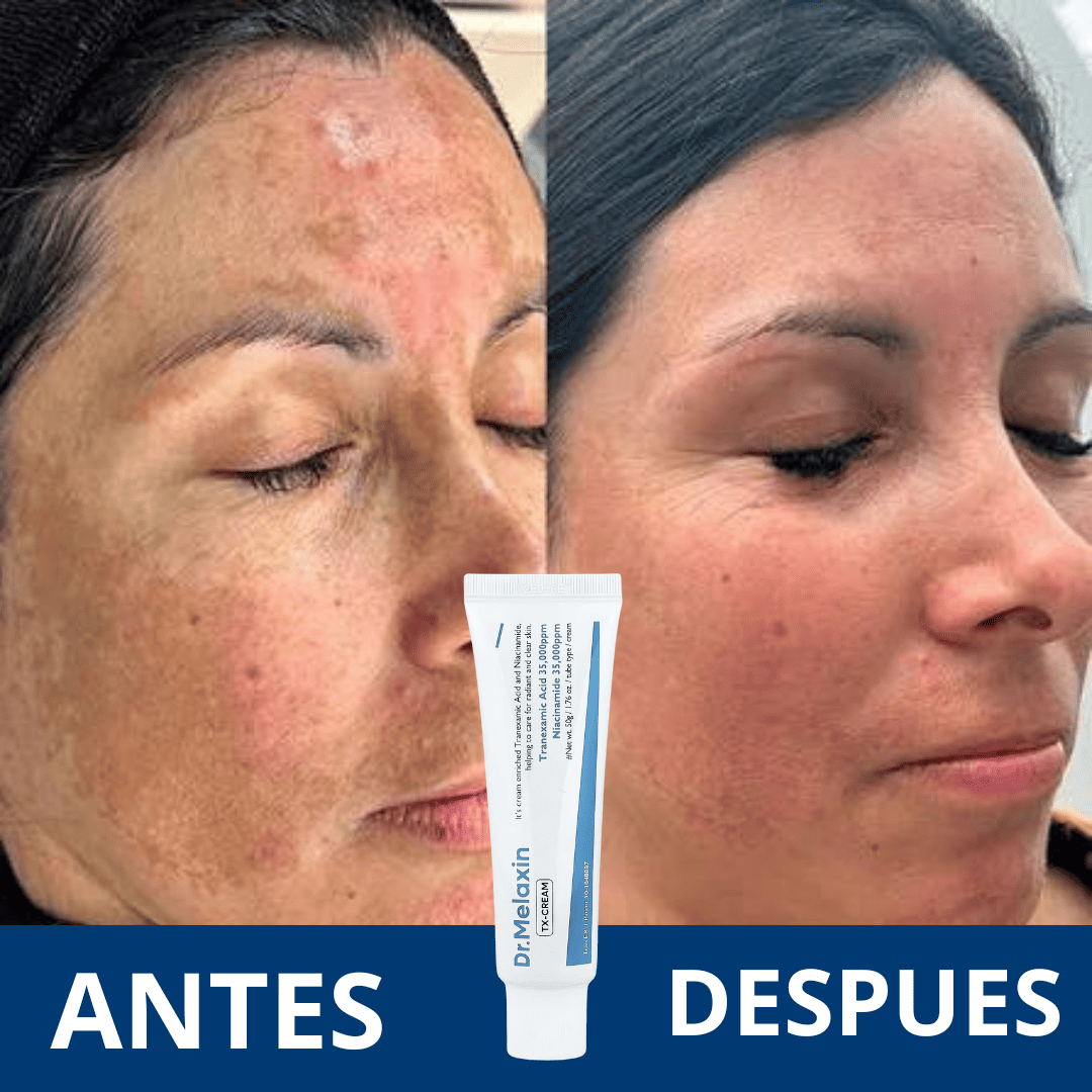 Dr. Melaxin - Crema para combatir manchas faciales