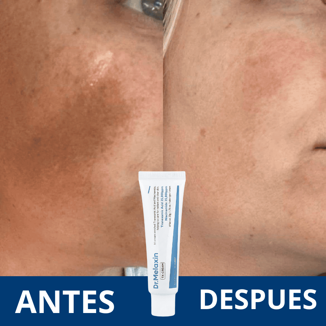 Dr. Melaxin - Crema para combatir manchas faciales