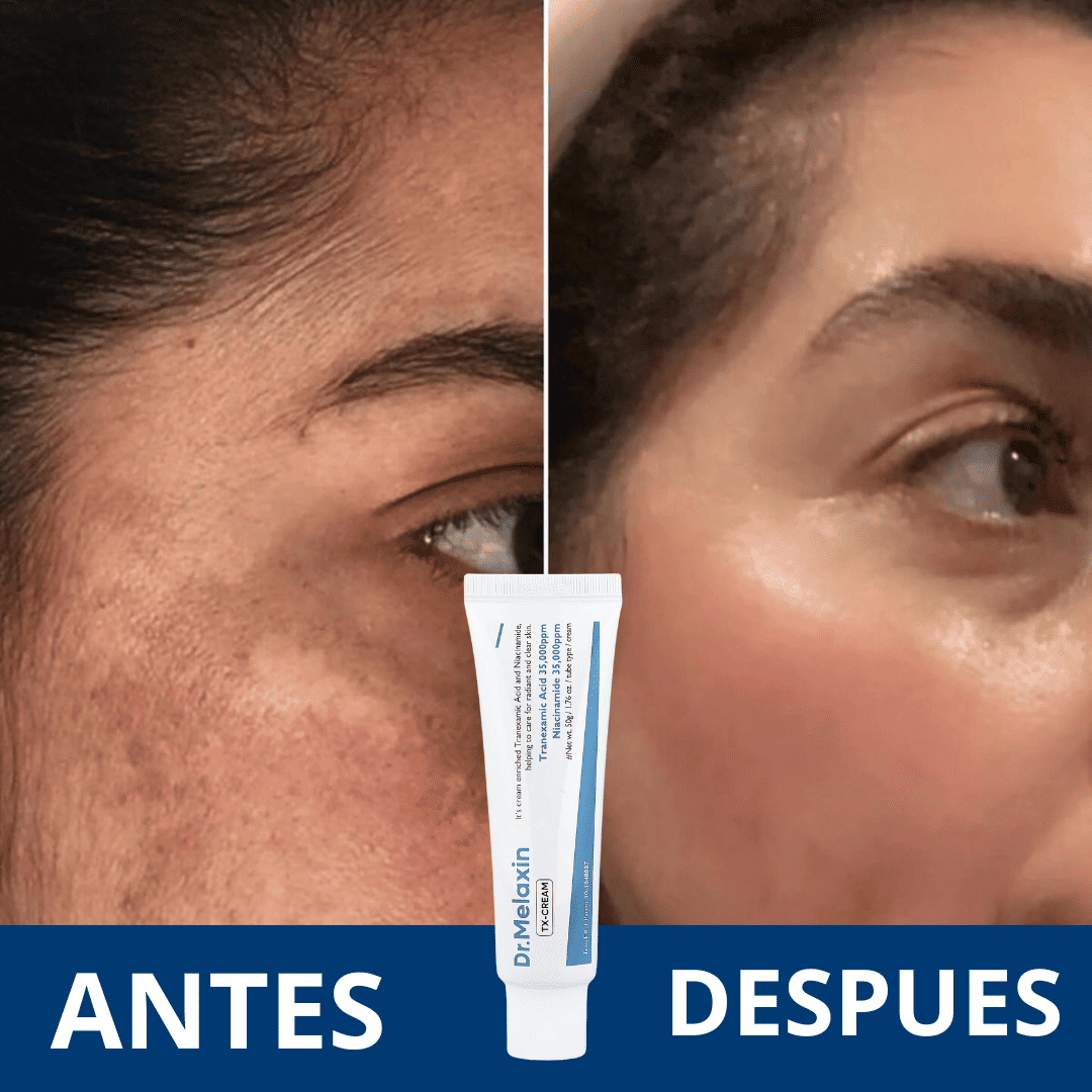 Dr. Melaxin - Crema para combatir manchas faciales