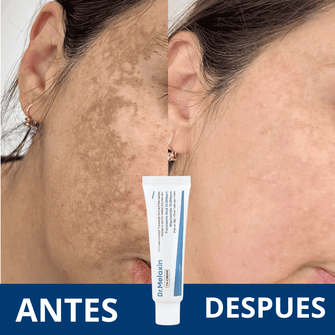 Dr. Melaxin - Crema para combatir manchas faciales