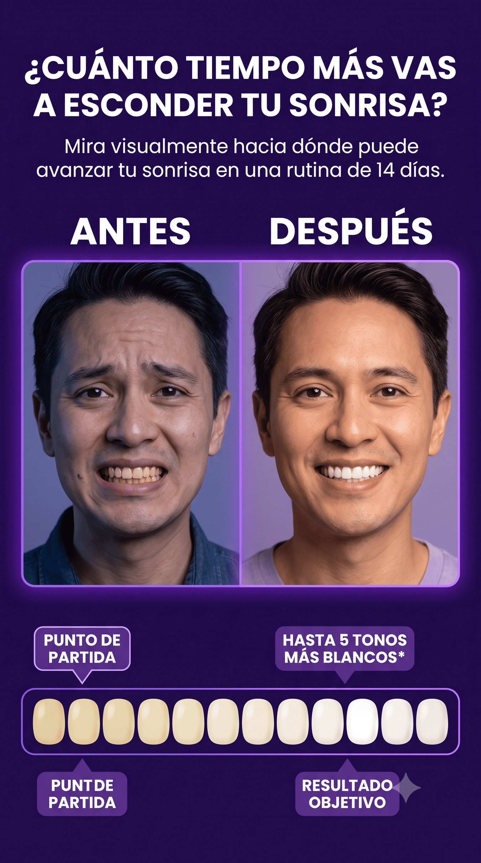 Tratamiento para blanqueamiento dental de 14 dias (ASEGURADO)