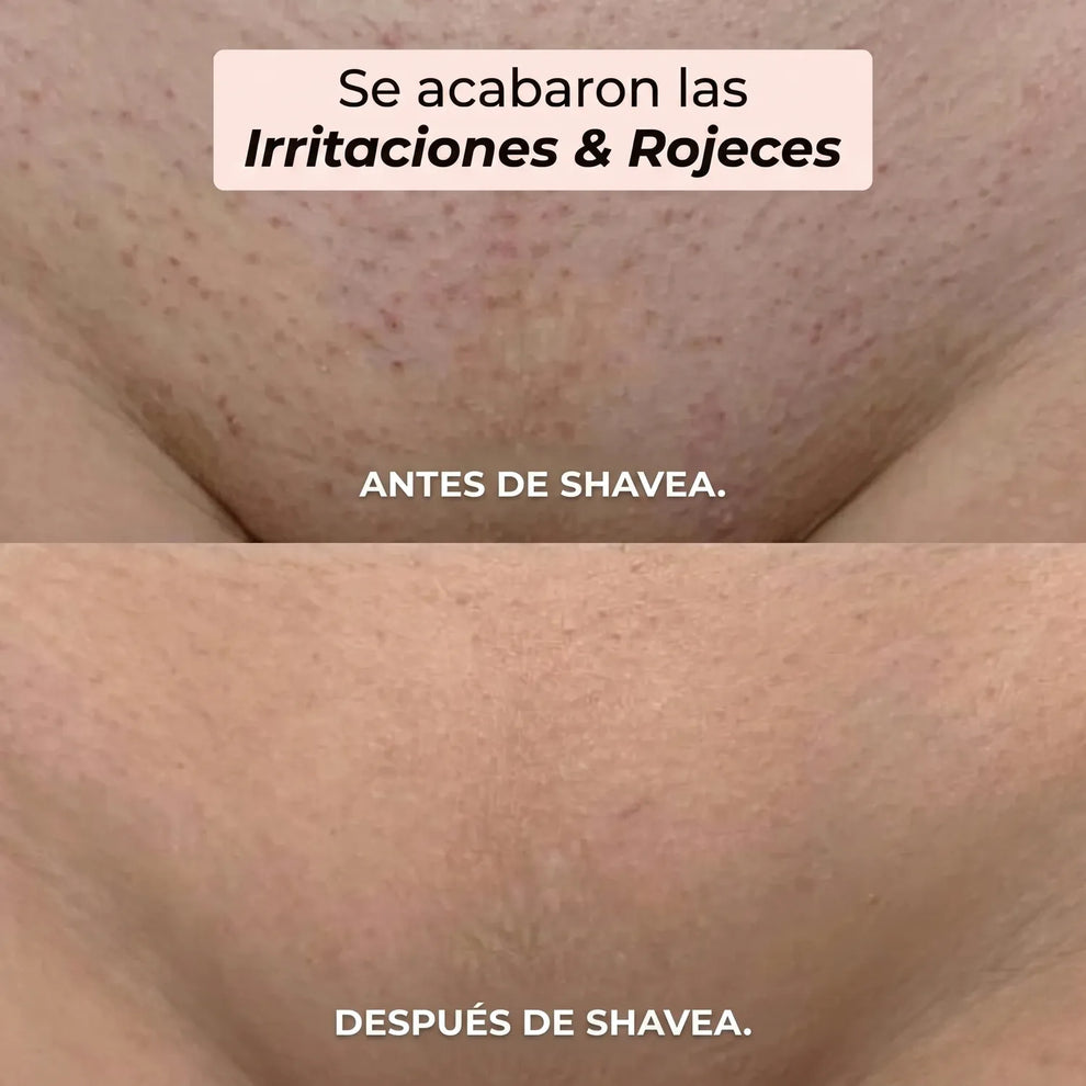 SHAVEA™ - AFEITADORA FEMENINA PARA CUERPO Y BIKINI