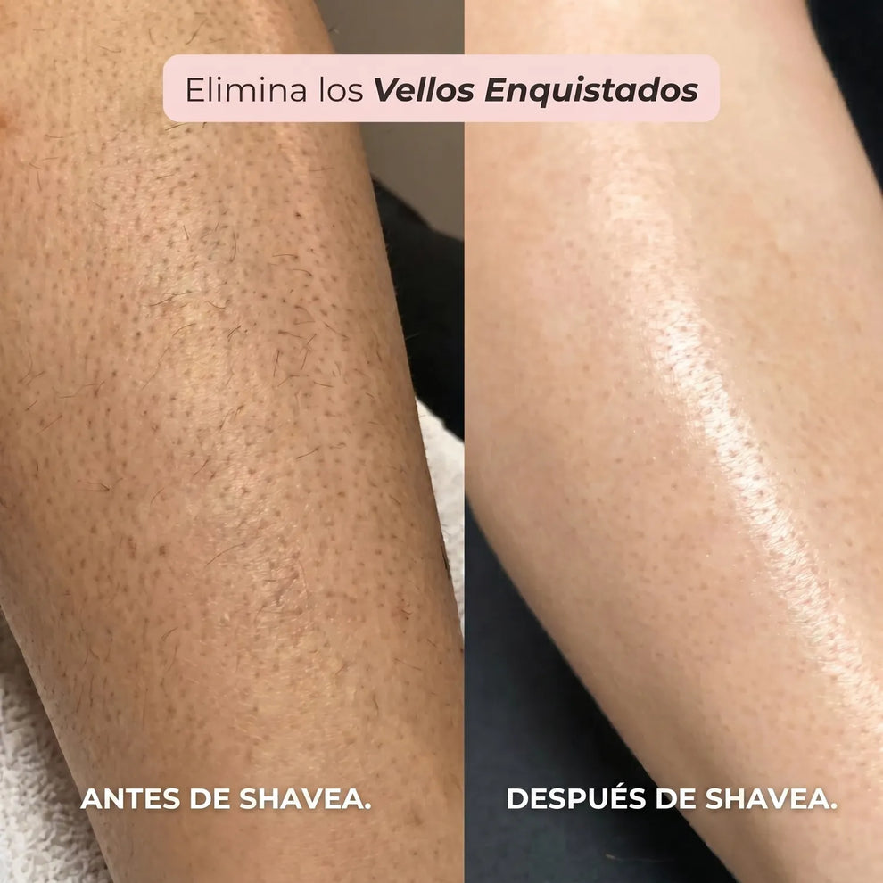 SHAVEA™ - AFEITADORA FEMENINA PARA CUERPO Y BIKINI